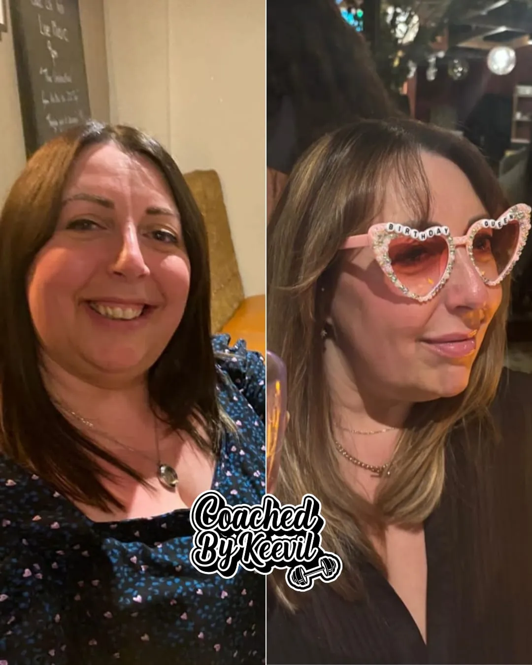 Nat's before and after — two nights out, one very different smile